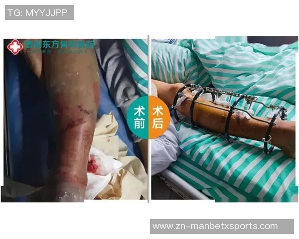 弗兰克透露比尔骨折如同车祸这并非常见篮球伤病